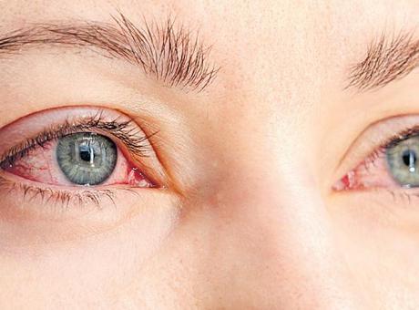 Diyabet gözlerinizi sessizce tehdit ediyor