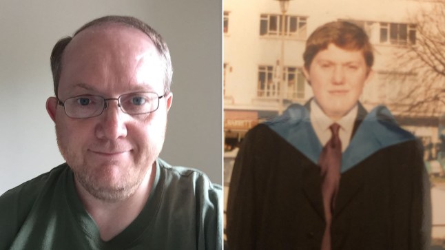 Hitler had a micropenis? I know the truth of living with Kallman Syndrome