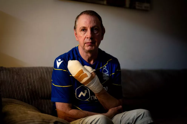 Hero of Huntingdon train attack says hand 'won't recover' after stabbing