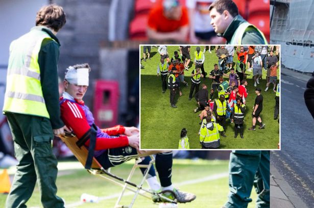 Aberdeen Ultra hit own player with broken seat and left him permanently disfigured