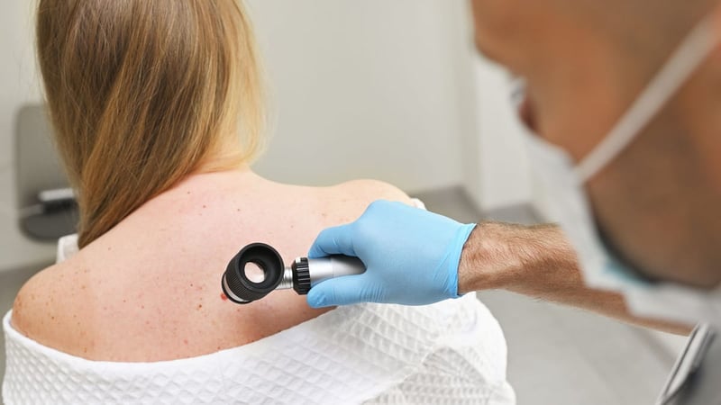 Hautkrebs-Screening: Wann und wie oft es sinnvoll ist