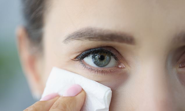 My watery eyes ruined my life. It's a condition that affects thousands and this is what a top surgeon told me is really to blame, the easy lifestyle tweaks that can help - and when it's time for surgery