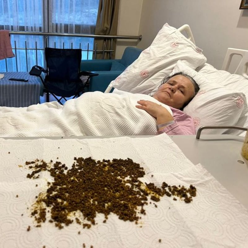 Sağlık ekibi de hasta da hayrete düştü! 20 binden fazla...