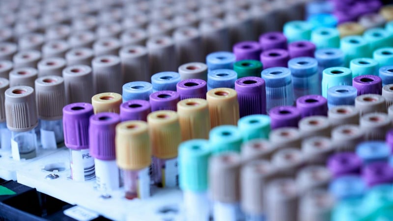 Del VIH al lupus pasando por la diabetes: una nueva IA detecta enfermedades analizando la 'huella inmunológica' personal