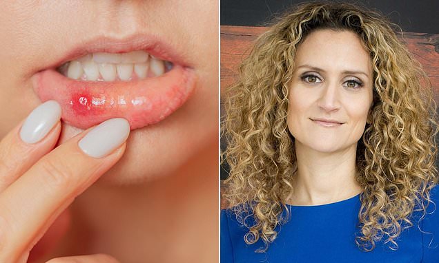 How can I get rid of these never-ending awful mouth ulcers? DR ELLIE has the answer