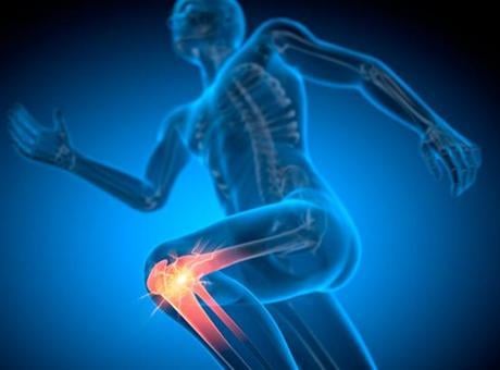 Menisküs yırtığı olanlar dikkat: Her yırtık cerrahi gerektirmiyor