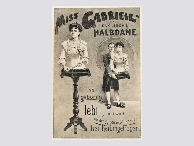 Dem Geheimnis auf der Spur: Die echte „Dame ohne Unterleib“