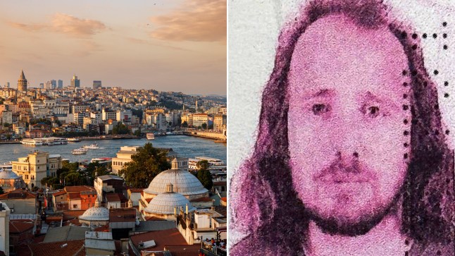 First picture of Brit, 36, who died after flying to Turkey for hair transplant