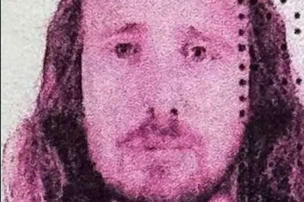 Brit went for a hair transplant and 'Turkey teeth' - within days he was dead