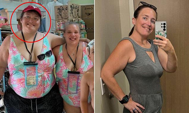 Callous advice from doctors who missed signs mom's weight loss surgery had gone horribly wrong... and it took NINE YEARS to fix