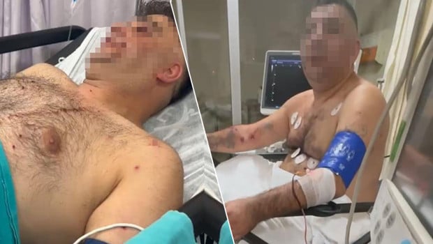 Pompalı tüfekli saldırgan terör estirdi: 1'i polis 4 yaralı