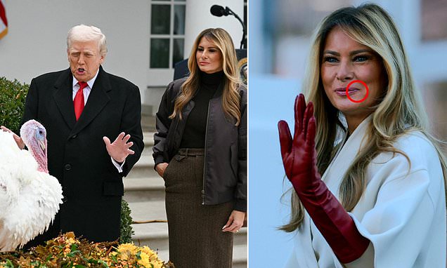 They snickered at 'Mar-a-Lago face' for years. Now America's elites are BEGGING to look like Melania... but insiders reveal horrific side effects