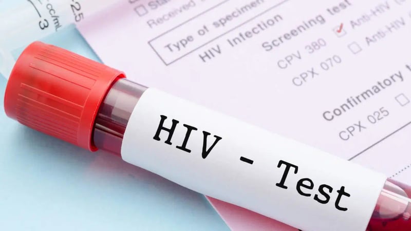 Uzmanlardan Dünya AIDS Günü çağrısı: ‘HIV’de erken tanı hayat kurtarıcı’