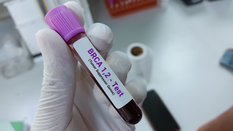 Why prostate cancer is expected to be left as the only major cancer without national screening