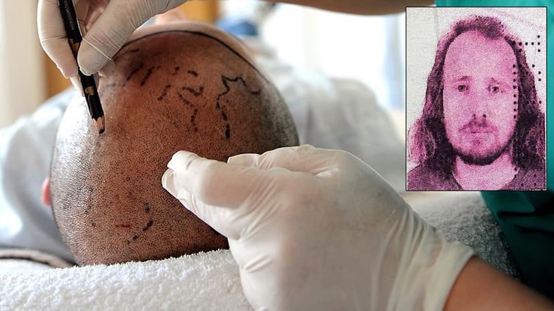 Saç ekimi ve diş tedavisi için Türkiye'ye gelen İngiliz vatandaşı öldü