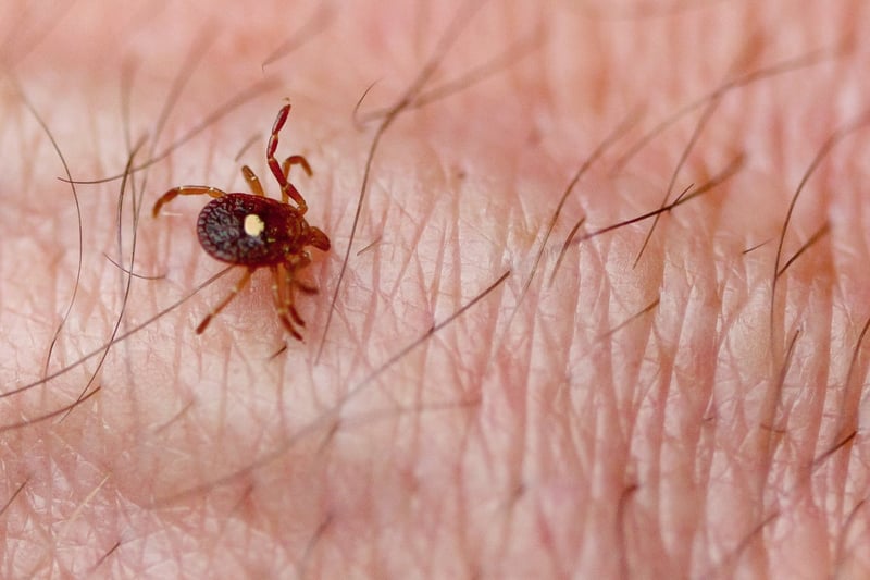 First death linked to tick-borne meat allergy reported