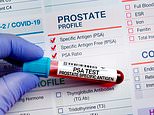DAILY MAIL COMMENT: Dithering on prostate tests will cost lives