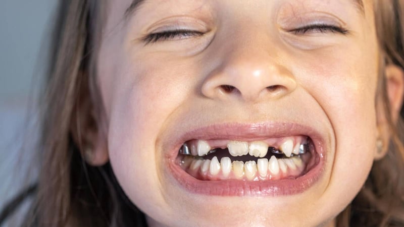 ¿Tu hijo pierde un diente por un golpe? El error con agua que jamás debes cometer, según un dentista