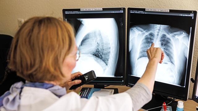 Gesundheit: WHO meldet weniger Tuberkulose-Infektionen