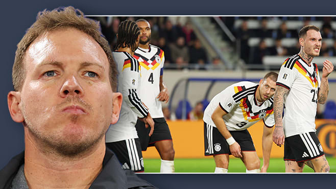 Was Nagelsmann jetzt dringend ändern muss - Hilfe, so sind wir nicht WM-reif!