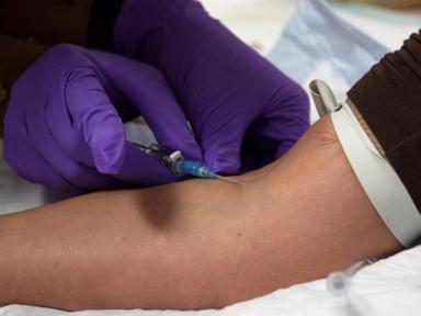 A closer look at the unapproved peptide injections promoted by influencers and celebrities