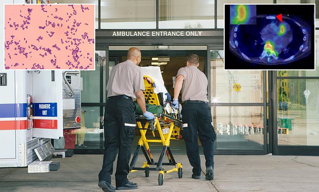 'Harmless' bacteria lurking in nearly all Americans triggered cascade of life-threatening infections... leaving me blind and close to death