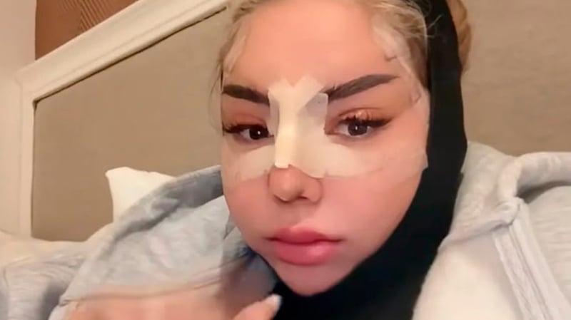 OP-Marathon bei Reality-Star - Neue Nase bringt Emma in Ekstase