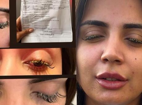 Güzelleşmek istedi, hayatı kabusa dönüştü: Gözlerim göremez hale geldi