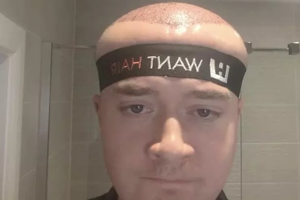 Man 'looks like he can remember the future' after procedure