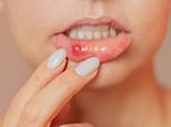 'My mouth ulcers keep coming back - what can I do?' DR ELLIE reveals the triggers, from three common foods to an item in everyone's bathroom - and the serious, lifelong disease they can be a symptom of