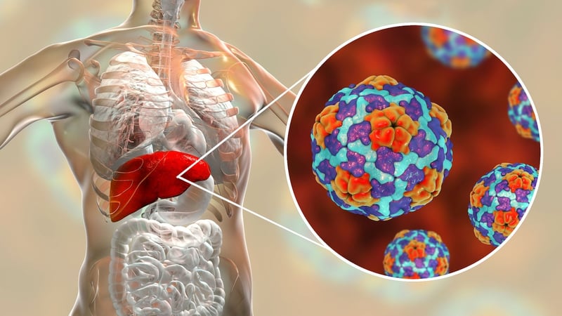 Hepatitis-A-Ausbruch an deutscher Grenze – wie Sie sich schützen