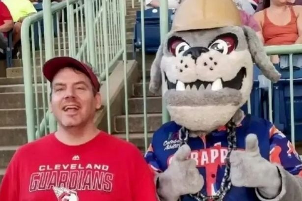 Man dies from chronic constipation after not pooing for a month