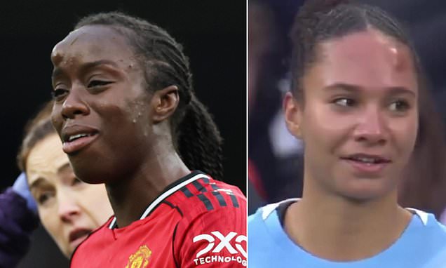 Man United and Man City Women's derby stopped as players suffer nasty clash of heads - and compare their bump sizes afterwards!