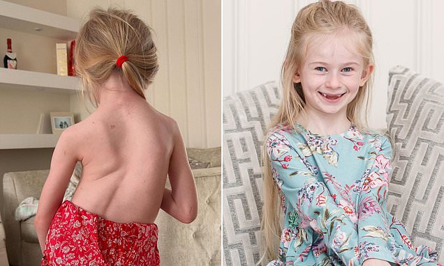 Mother issues warning after daughter, 4, was left with serious spinal injury during trip to soft play